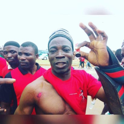 7 Protesters Lost Their Lives As Togo Protests Against 50-Year Ruling Dynasty Turns Bloody [Graphic Photos]