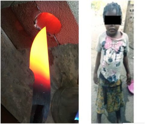 So Sad!!! Wicked Aunt Inserts Hot Knife In Niece’s Private Part Over This