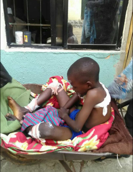 Man Takes Son To Hospital In Wheelbarrow In Imo State After Waiting Hours But No Available Vehicle [Photos]