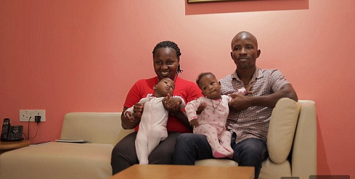 22 Doctors Successfully Separates Nigerian Conjoined Twins Undergo [Photos]