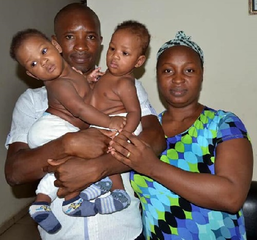 22 Doctors Successfully Separates Nigerian Conjoined Twins Undergo [Photos]