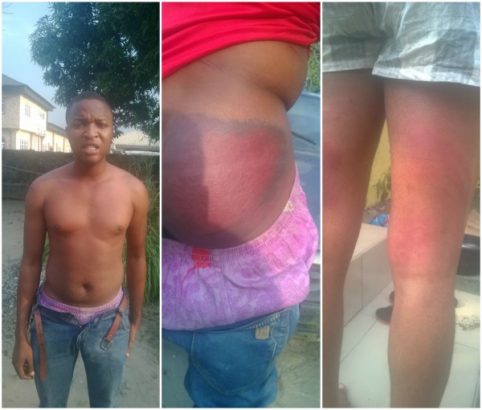 Corp Member Flogged Blue Black In Kebbi After Accused Of Stealing Chickens [Photos]