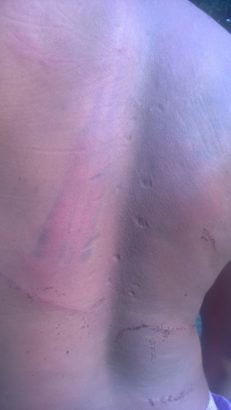 Corp Member Flogged Blue Black In Kebbi After Accused Of Stealing Chickens [Photos]