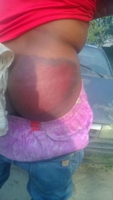 Corp Member Flogged Blue Black In Kebbi After Accused Of Stealing Chickens [Photos]