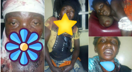 Suspected Fulani Herdsmen Attack Kaduna Again, ‘Butcher’ Many In Nindem Village [Photos]