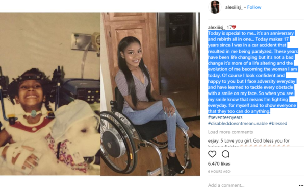 Beautiful Lady Drops A Heart Melting Post As She Celebrates 17th Year Of Being Paralyzed