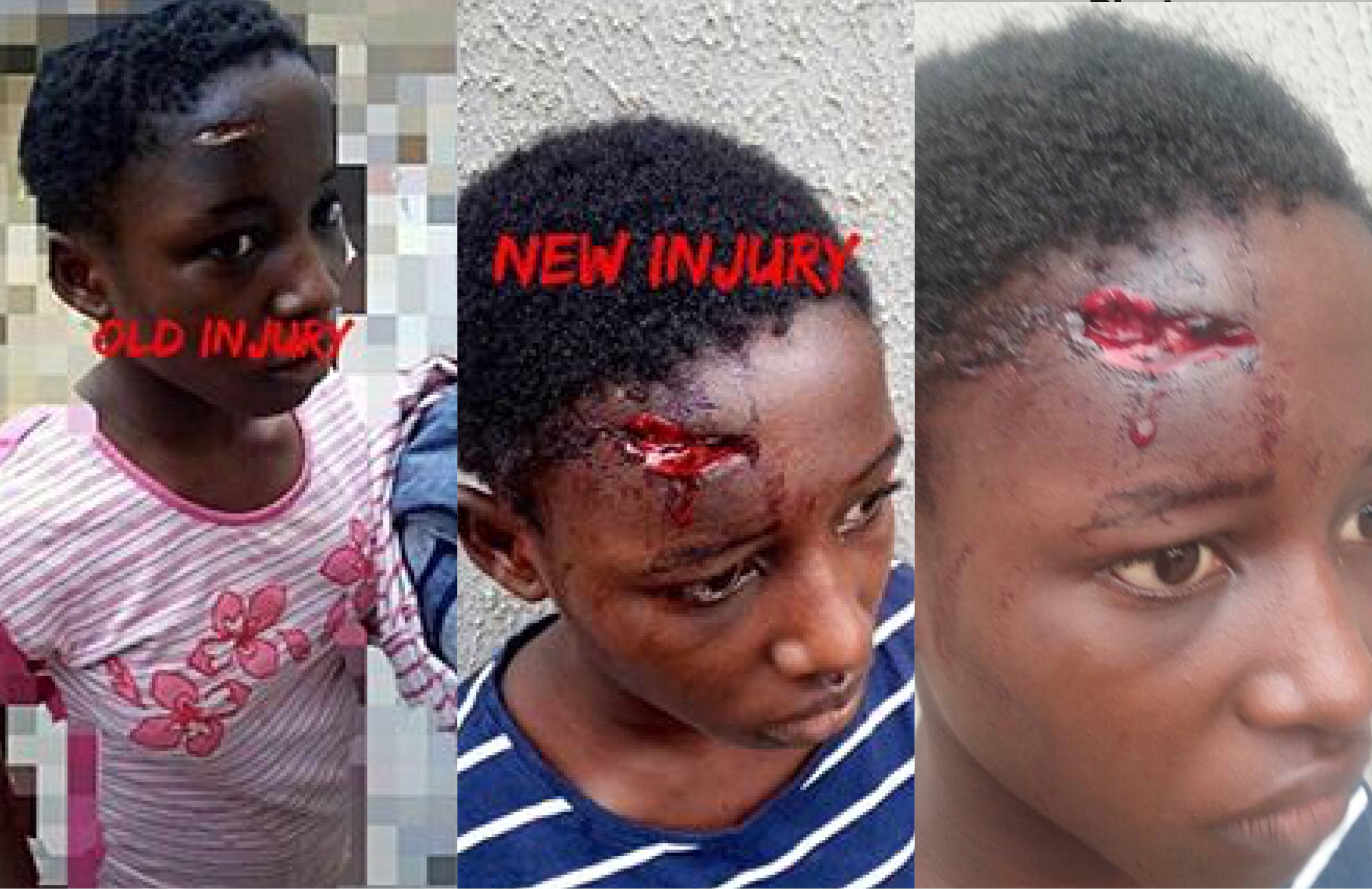 Lagos Lawyer in Trouble for Allegedly Abusing House-Help and Inflicting Injuries On Her [Graphics Photos]