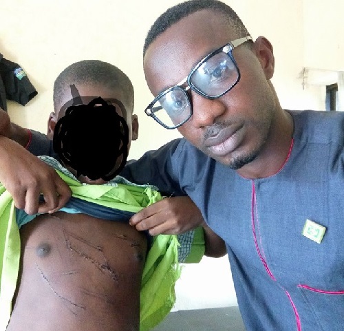 Little Girl Who Was Brutalized And Raped Several Times By Her Aunt’s Husband Rescued In Delta State