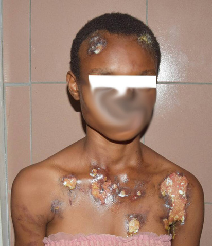 Heart Breaking Photos Of A Lagos Maid Tortured By Madam And Raped Through The Anus By Husband