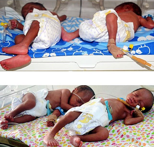 Endless Jubilation As NAN’s Editor-In-Chief Welcomes Quadruplets After 7 Years Of Marriage