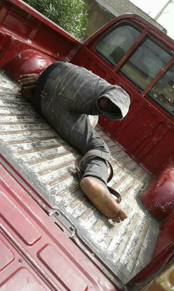 SHOCKER: Police Arrested a Notorious One-Legged Thief [Photos]