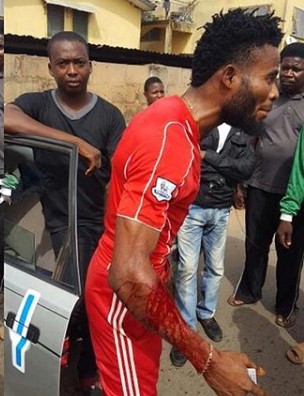 SARS Again Brutalizes Young Man in Benin, Edo State [Photos]