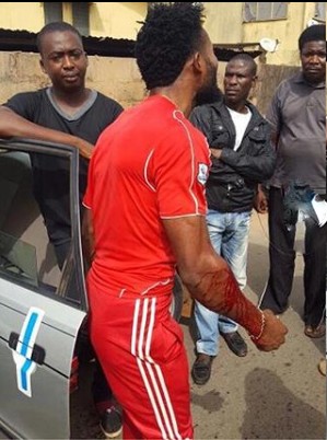 SARS Again Brutalizes Young Man in Benin, Edo State [Photos]
