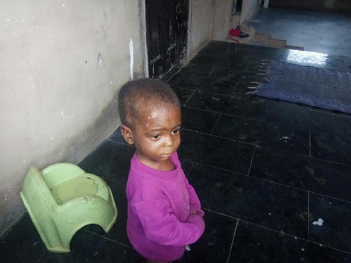 Photos Of Two-Year-Old Boy Maltreated By His Step-Mother And Father In Benin [Photos]