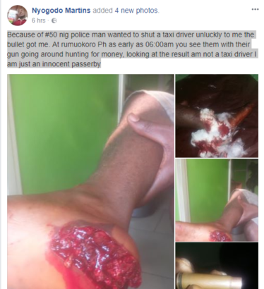 Photos Of Nigerian Man Hit By Stray Bullet From Policeman Trying To Collect #50 Bribe 
