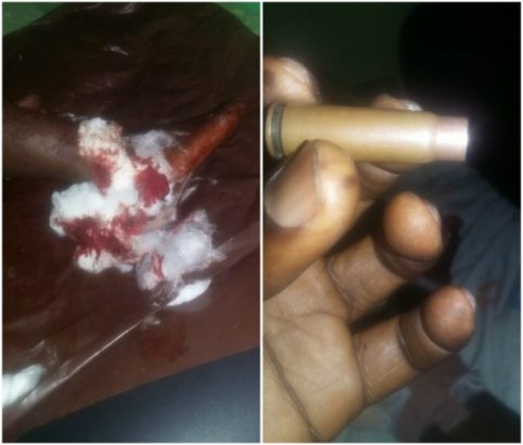 Photos Of Nigerian Man Hit By Stray Bullet From Policeman Trying To Collect #50 Bribe 