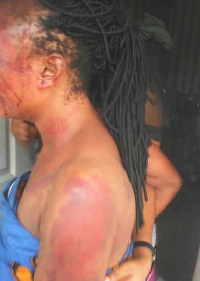 Hoodlums Beats Pregnant Woman To Coma, After Taking Tramadol In Rivers [Photos]