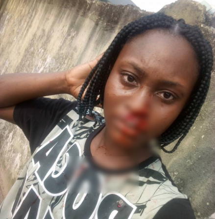 300 Level UNIPORT Student Accused Of Slashing Her Roommate Nose With Razor [Photos]