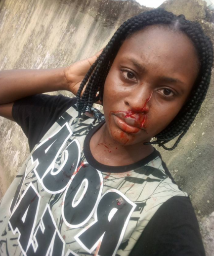 300 Level UNIPORT Student Accused Of Slashing Her Roommate Nose With Razor [Photos]