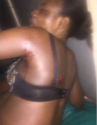 8-Months Pregnant Woman Shot by Custom Officers In Ogun State