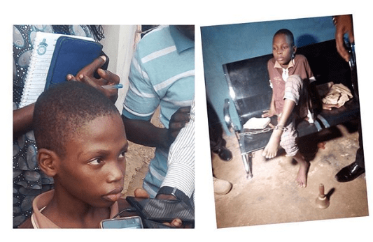Police Rescues 12 Years Old Boy Chained By Grandmother, Mother For Months [Photos]