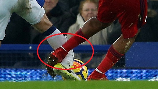 Player In Tears After Breaking Opponent’s Leg During Premier League Match On Saturday [Photos]