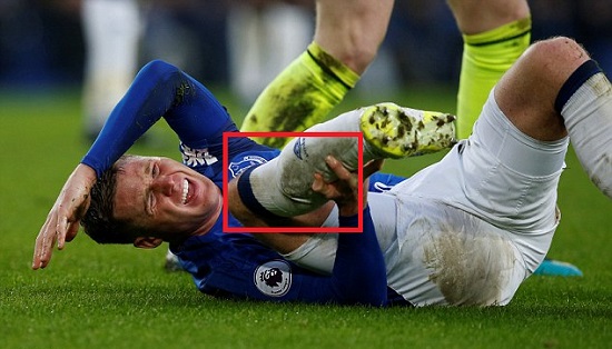 Player In Tears After Breaking Opponent’s Leg During Premier League Match On Saturday [Photos]