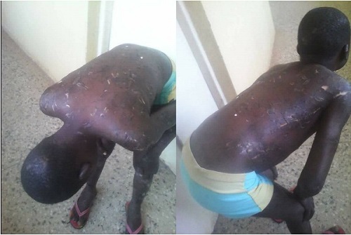 UPDATE: Remember The Boy That His Father Flogged For Losing Their House Keys? His Father Has Been Arrested