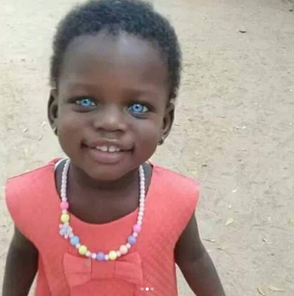 Viral Photos Of A Little Ghanaian Girl With A Striking Blue Eyes [Photos]