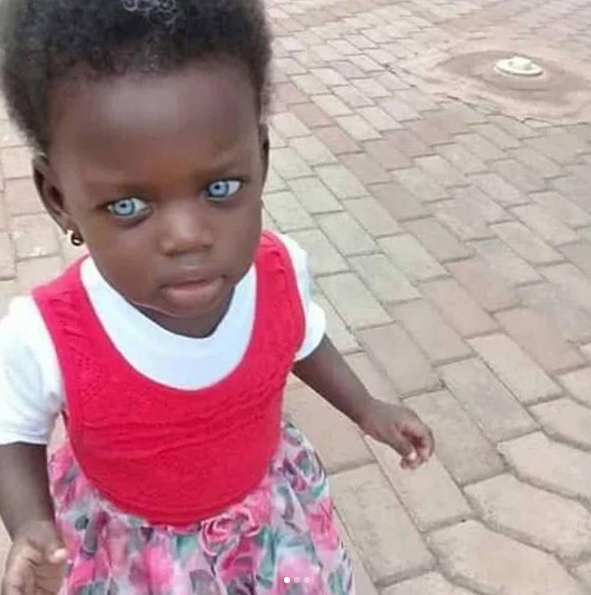 Viral Photos Of A Little Ghanaian Girl With A Striking Blue Eyes [Photos]