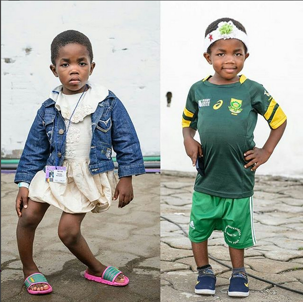 Photos of 5-Year-Old Girl with ‘Windswept Legs’ After Undergoing Surgery