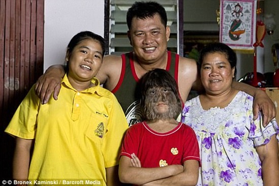For The First Time Ever, World Hairiest Girl Shaves Off Her Face As She Wants To Get Married 