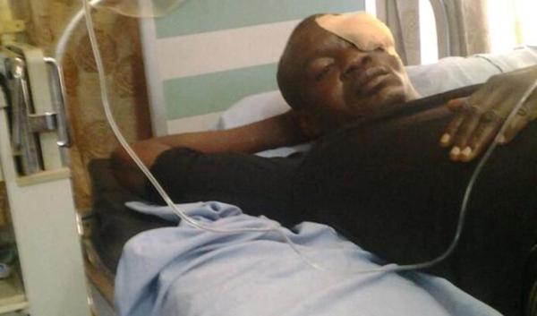 Man Sleeps with His Neighbor’s Wife, Beats and Blind One Eye Of Her Husband After He Caught Them