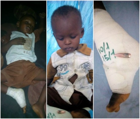 Sleeping Little Boy Cheats Death as Stray Bullet Penetrates Roof and Hits Him [Photos]