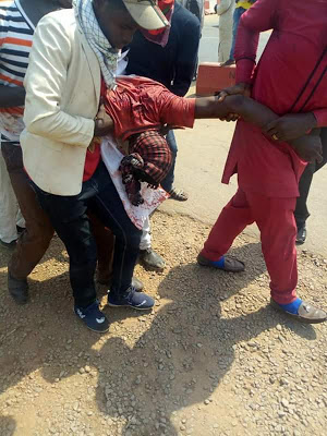 Police Blows Up The Brain Of A Protesting Shiite Member In Abuja [Graphic Pics]
