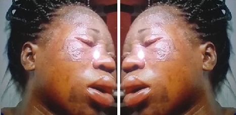 Angry Wife Pours Hot Water On A Lady For Having S*X With Husband [Photos]