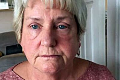 63 Year Old Grandmother, Who Went For A Breast Reduction Is Left With No Nipples After Surgery [Photos]