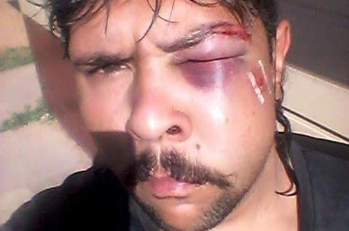 Photos of What a Kangaroo Did to A Hunter Who Tried to Mess with It