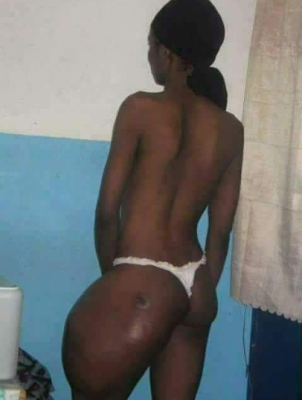 After Result Of Lady That Took Injection In Order To Increase The Size Of Buttocks [Photos]