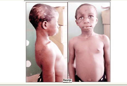 Barren Woman Tortures, Inserts Stick into Adopted Daughter’s Private Part [Details]