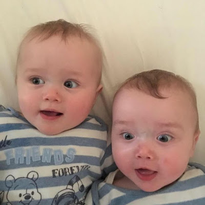 Unbelievable!!! 19 MONTHS OLD Boy Suffers STROKE [Photos]