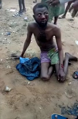 Yahoo Boy Nearly Beaten to Death for Cleaning Someone’s Urine with Handkerchief [Photos]