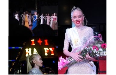 Chai!!!Zimbabwe’s Miss Albino Beauty Pageant, Winner Gets $85