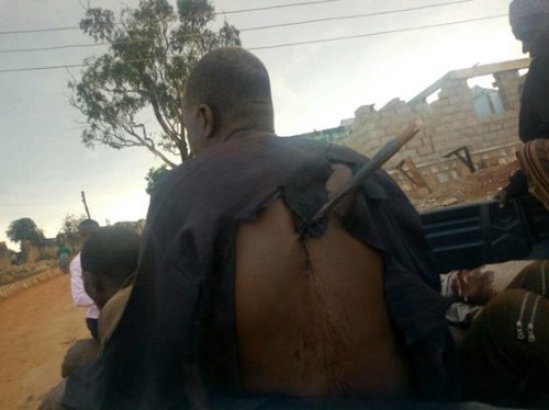 Man Luckily Escapes with Arrow in His Back After Attack by Fulani Men [Photos]