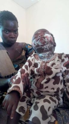 Heartless Landlady Pours Hot Porridge On Tenant’s 1-Year Old Baby  