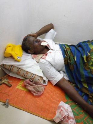 Blood Reportedly Flows from Rev. Sister’s Hand, Feet, Head and Eyes [Photos]