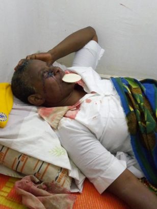 Blood Reportedly Flows from Rev. Sister’s Hand, Feet, Head and Eyes [Photos]