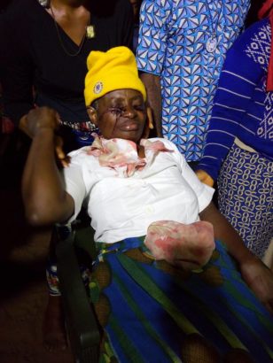 Blood Reportedly Flows from Rev. Sister’s Hand, Feet, Head and Eyes [Photos]