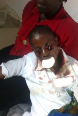 Blood Reportedly Flows from Rev. Sister’s Hand, Feet, Head and Eyes [Photos]
