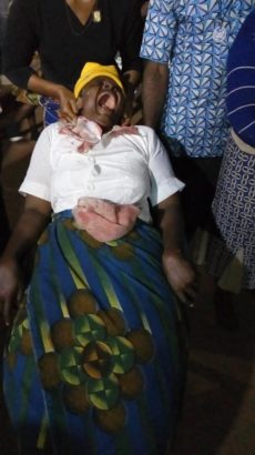 Blood Reportedly Flows from Rev. Sister’s Hand, Feet, Head and Eyes [Photos]